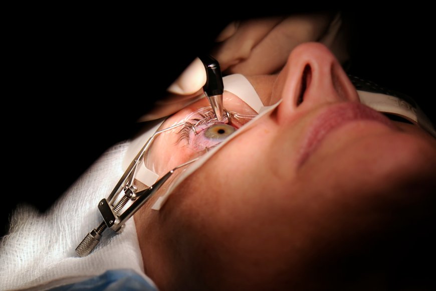 FDA Adviser Who Backed Lasik Surgery Now Opposes It