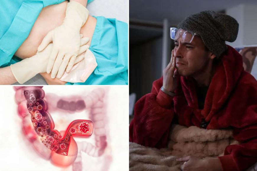 Millennials born in 1990 are twice as likely to get colon cancer as Boomers born in 1950 — and that’s not the worst of it…