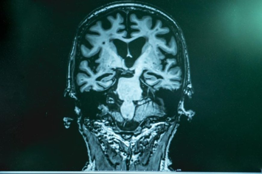 Newborn Babies and Alzheimer’s Patients Have This Surprising Thing in Common