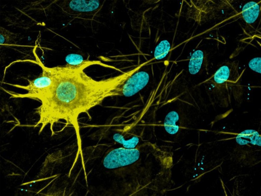 Scientists Grow 400+ Brain Cell Types in a Dish – Could This Be the Key to Curing Alzheimer’s?