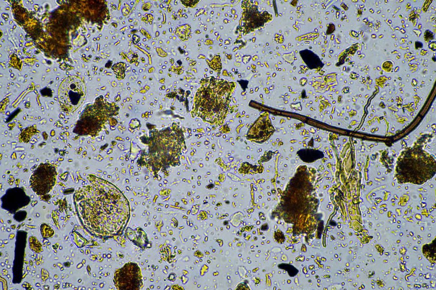 Curious New Microbe With Tiny Genome Toes The Line Between Cell And Virus