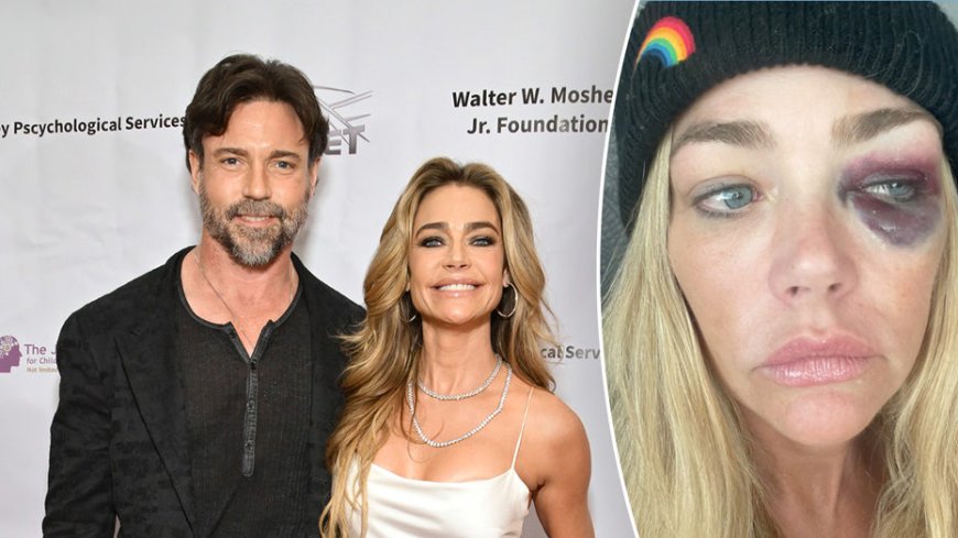 Denise Richards' estranged husband fires back at violent abuse allegations