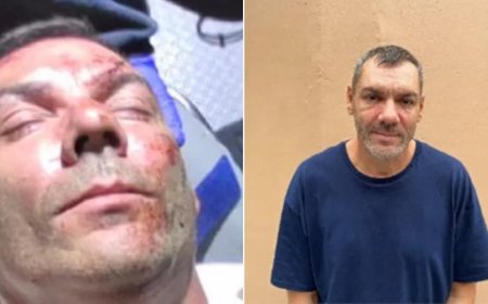 Romanian Scammer Faked Injuries to Be Smuggled Into US in Mexican Ambulance