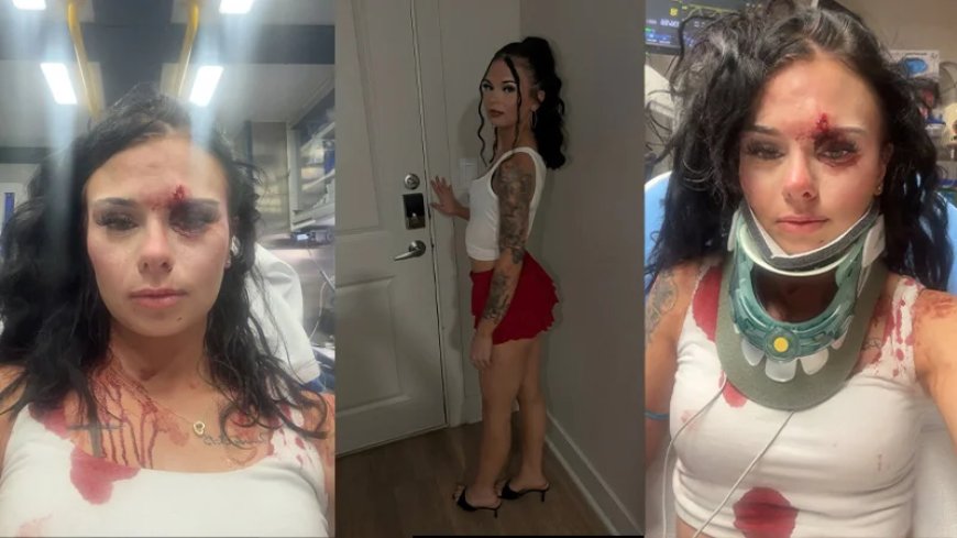 “Free Karmelo!” — Texas Woman Claims She Was Racially Targeted By Black Girls, Viciously Beaten Outside Bar