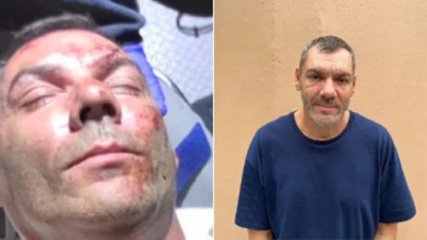 Romanian Scammer Faked Injuries to Be Smuggled Into US in Mexican Ambulance