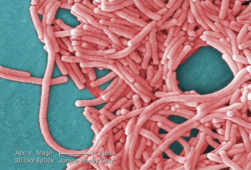 Hamilton’s legionnaires’ disease outbreak declared over