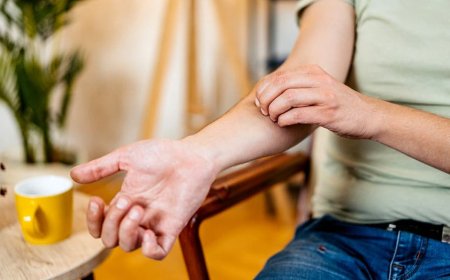 Why scratching a mosquito bite makes it so much worse, according to science