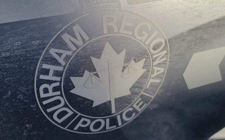 Toddler bitten in the face by coyote at Whitby, Ont., playground: police