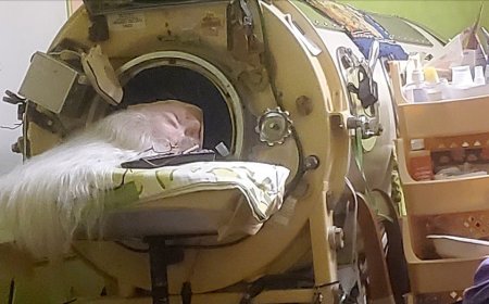 Last American to use an iron lung dies at 78 years old after childhood polio diagnosis