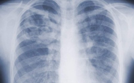 Are you underestimating mold-related illness? What U.S. study says