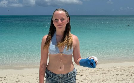 Texas teen bitten by barracuda in popular vacation spot after bracelet glints in water