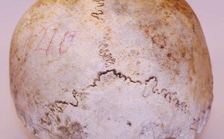 Skull found in 1975 belongs to Uxbridge, Ont. WWI veteran: police