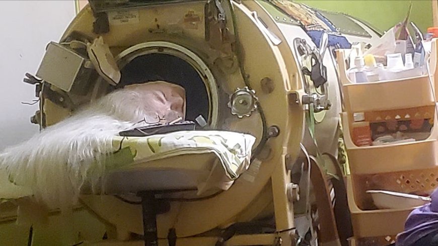Last American to use an iron lung dies at 78 years old after childhood polio diagnosis