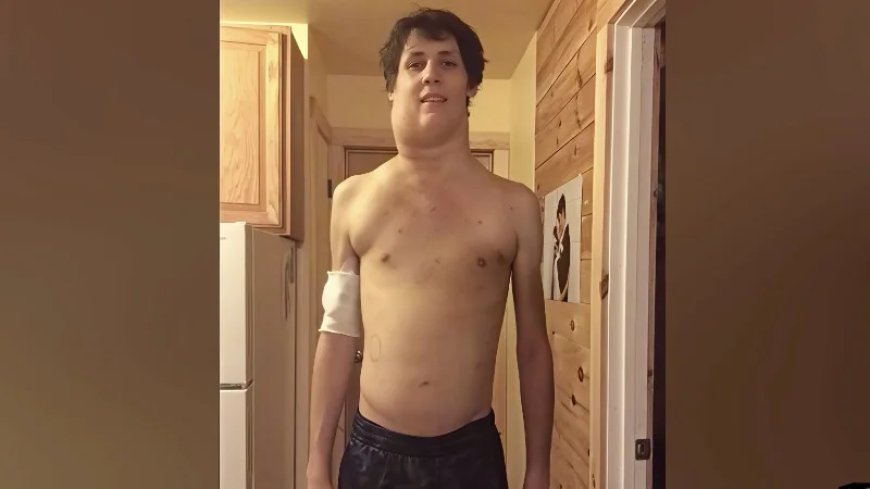 Watch: Tennessee Teen Drenched In Glyphosate Spent Next 7 Years Fighting ‘Massive Alien’ Tumor