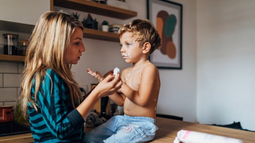 Measles surge hits new milestone as US cases surpass last year's total