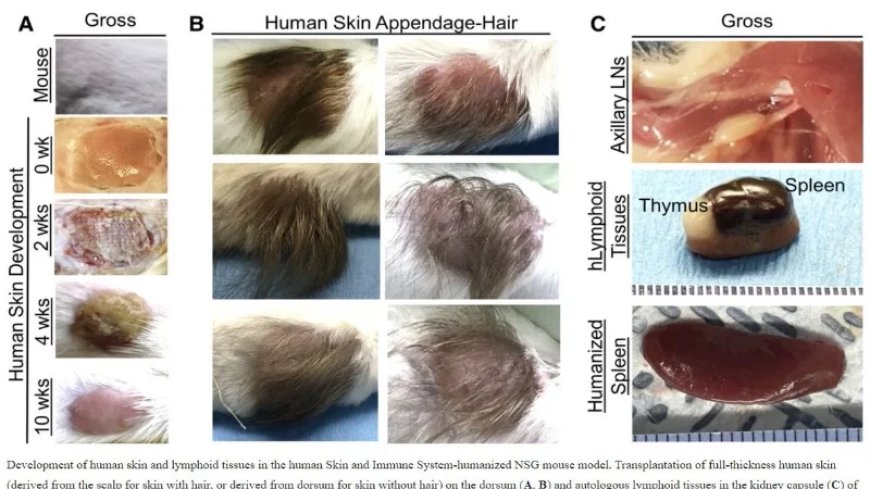 Fauci Played A Role In Study That Grafted Aborted Baby Scalps Onto Rats