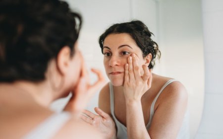 Skin condition under the eyes goes viral as doctors warn it could signal hidden health issue