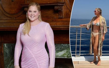 Amy Schumer earns praise for sharing unfiltered bikini photos amid her weight-loss journey