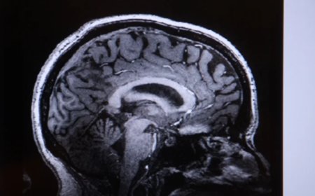 Study: Being Overweight Associated with Reduced Brain Mass