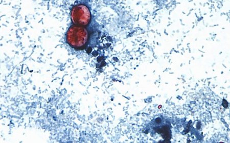 Michigan reports first U.S. deaths from multi-state cyclosporiasis outbreak