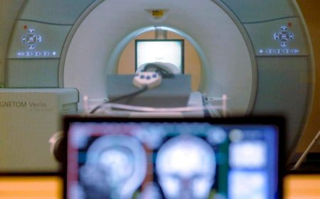 Clinics, technicians unsure of Alberta’s new self-referral method for health tests