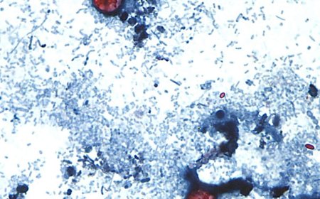 Cyclospora outbreak tied to lettuce now linked to 15 states: reports