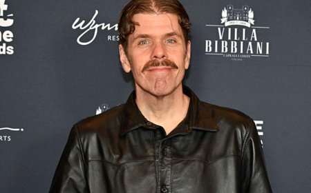 Perez Hilton in ‘serious but stable’ condition, will need surgery, family says