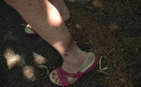 Quebec health officials confirm 2nd Montreal cat with raccoon rabies