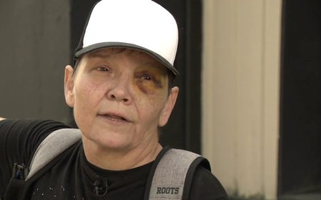 Vancouver woman says she’s disappointed random assault suspect already released