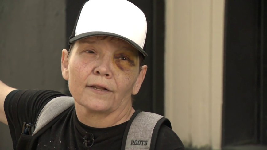 Vancouver woman says she’s disappointed random assault suspect already released