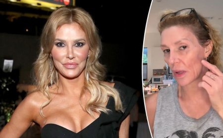 Brandi Glanville speaks out on complex diagnosis and $6K monthly medical battle