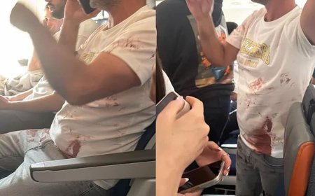 Co-Pilot Stabs Captain in Mid-Air Terror Attack on Board Packed Passenger Jet