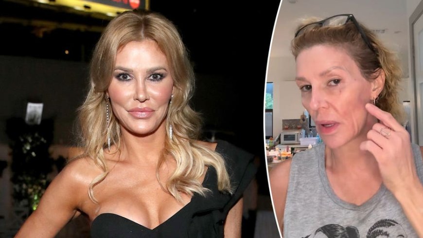 Brandi Glanville speaks out on complex diagnosis and $6K monthly medical battle