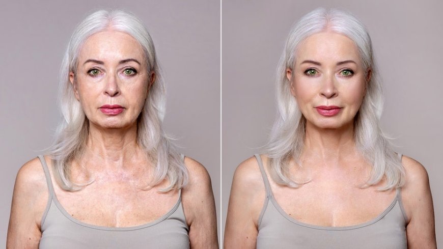 Celebrity plastic surgeon reveals when it's too soon for a facelift, and when waiting can backfire