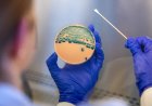 Stomach-turning sexually transmitted infection is on the rise — and standard medicines are failing