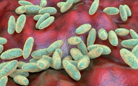 US monitoring suspected fatal pneumonic plague case in Russia, State Department official says