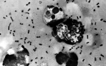 White House Monitoring Russian Plague Outbreak