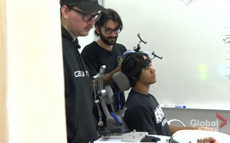University of Regina studies new concussion treatment option: CBD