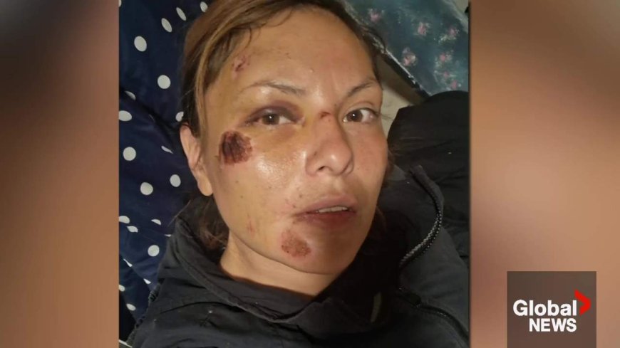 ASIRT looking into Edmonton woman’s allegation of unprovoked police assault: ‘Smashed my face’