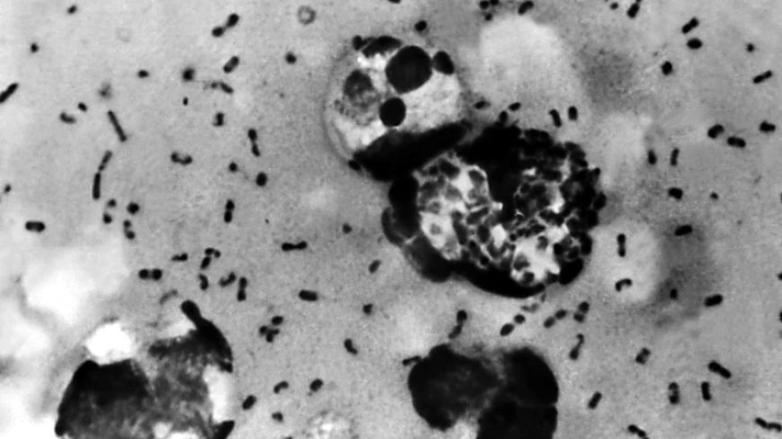 White House Monitoring Russian Plague Outbreak